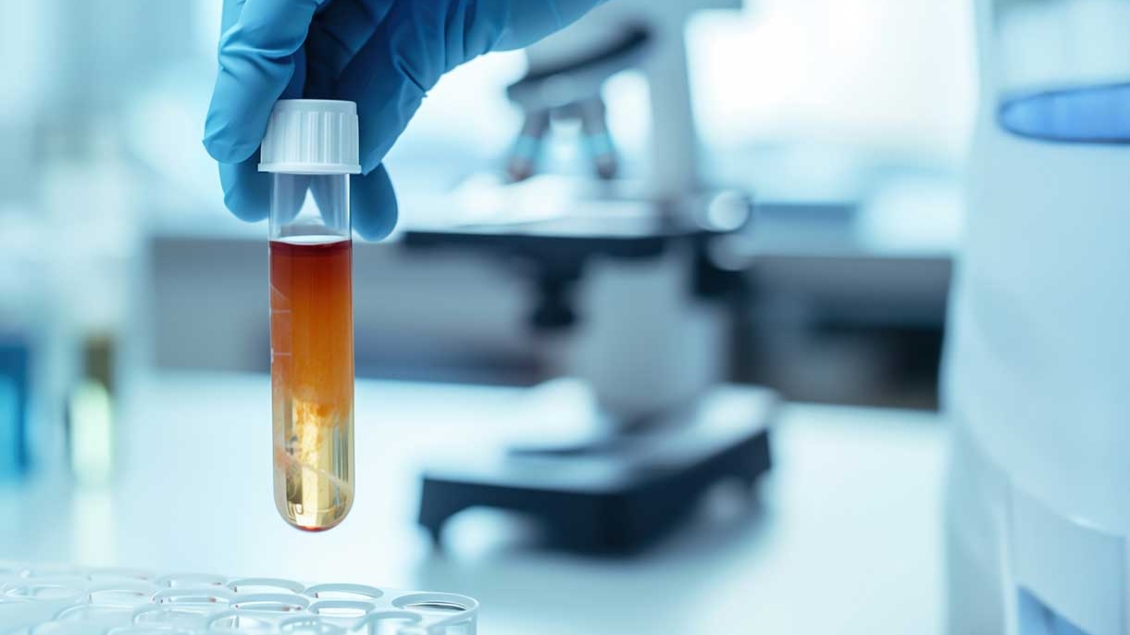 Gloved hand places a blood specimen into a tray