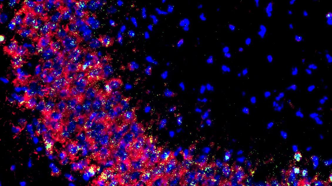 Confocal Image scn1b RNA