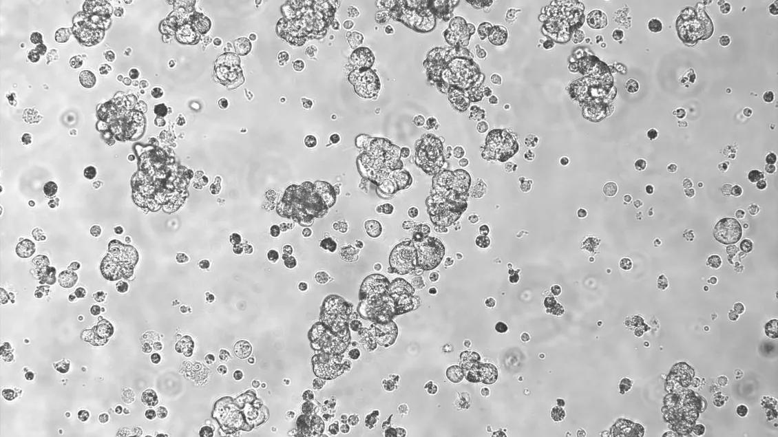 organoids
