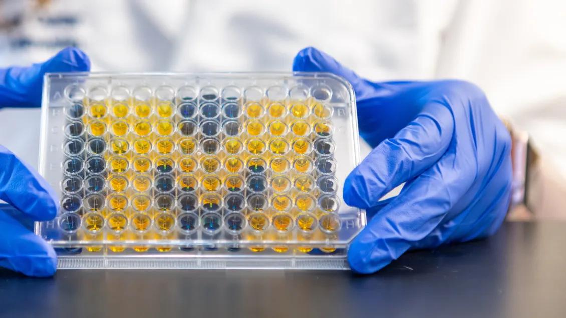 Scientist holding plate with big yellow M
