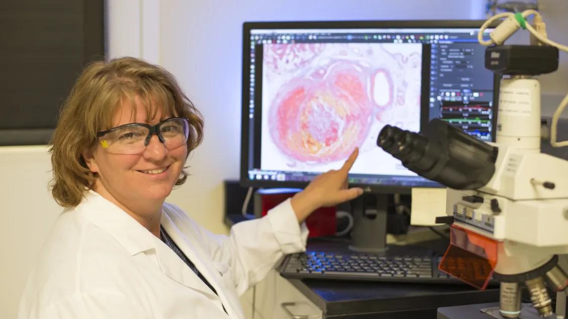 A woman in safety goggles and a white lab coat points at a cell stain on a screen. 