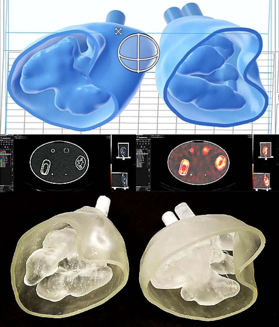 Kidney phantom model image