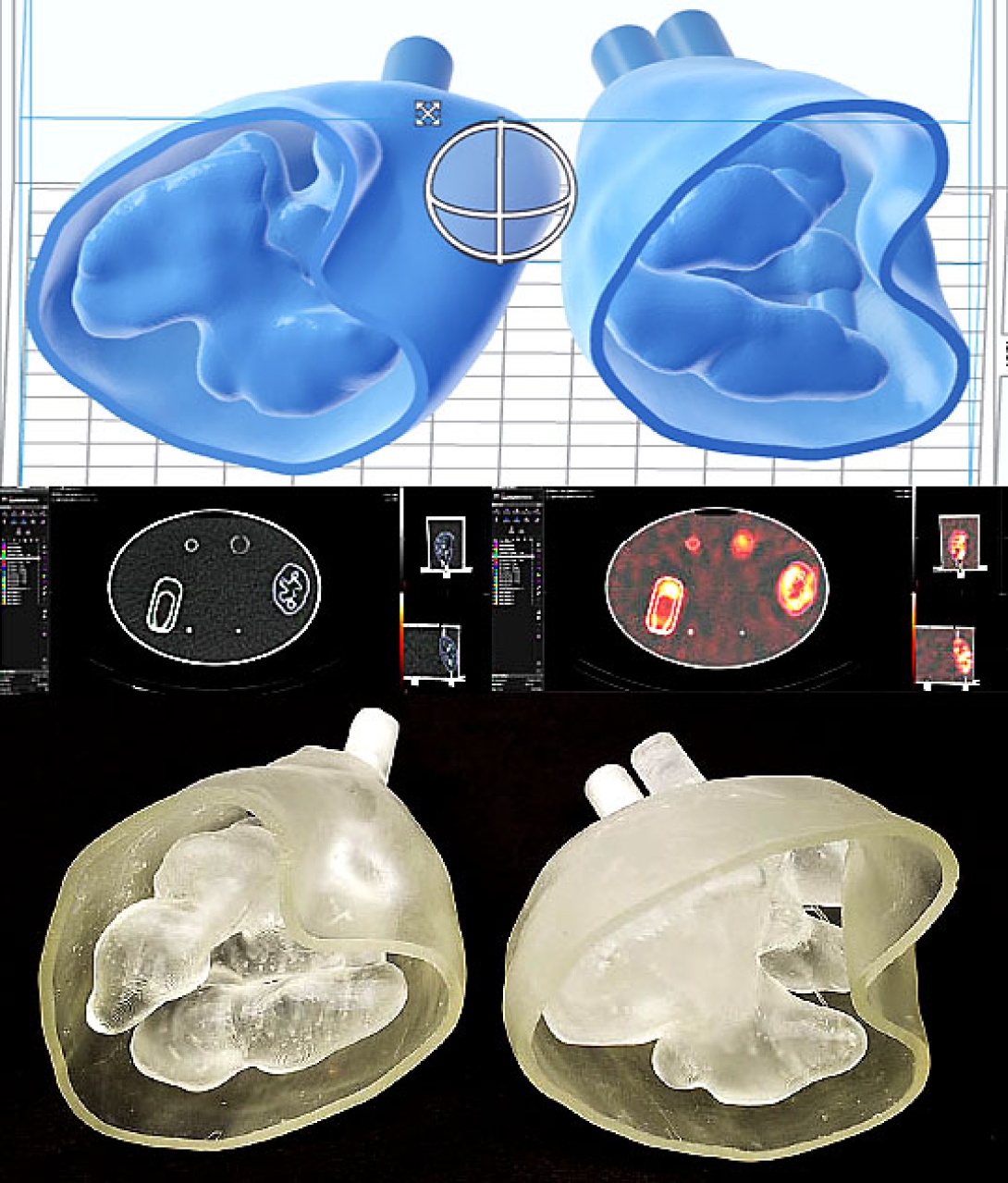 Kidney phantom model image