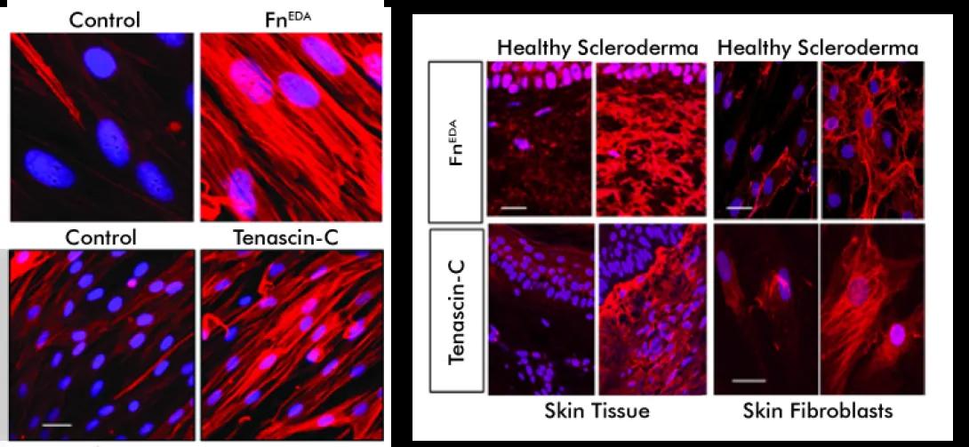 intmedrheumvargalabresearchsclerodermaimages (1).png
