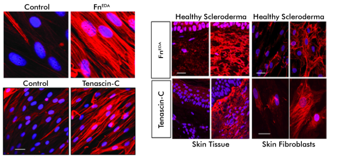 intmedrheumvargalabresearchsclerodermaimages (1).png