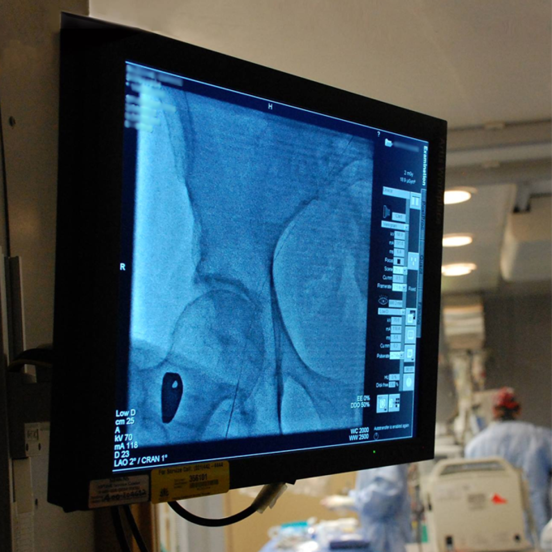 angioinsight