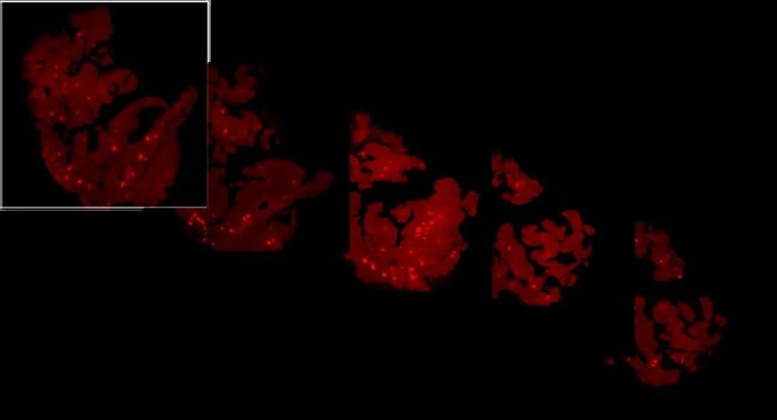 beta-cell-mass-multiple-images