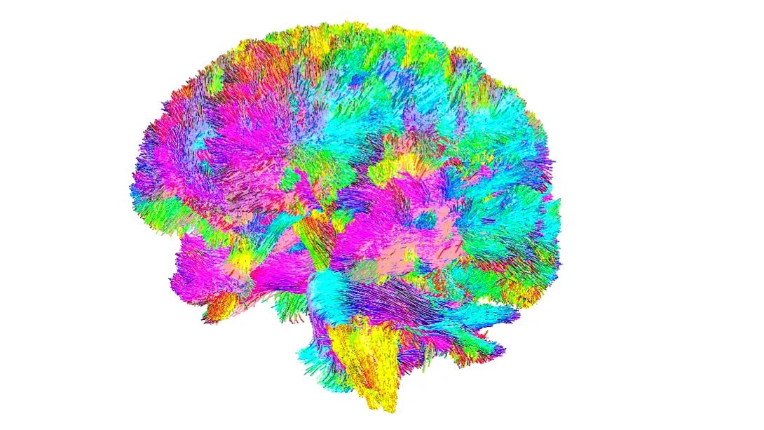 brain tractography showing different nerve tracts in a human brain denoted in different colors