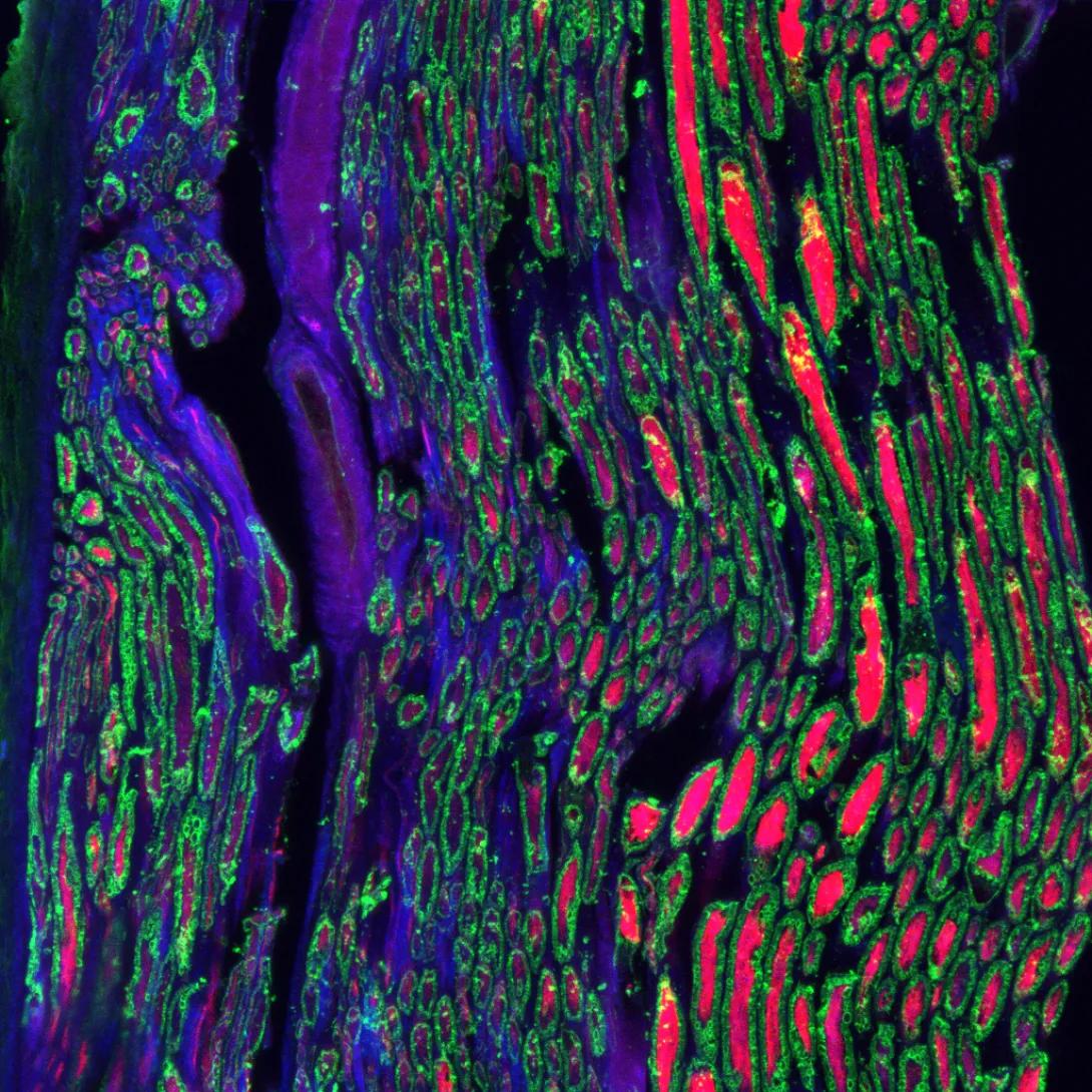 nerve axons shown in red, myelin shown in green and inflammatory markers in blue