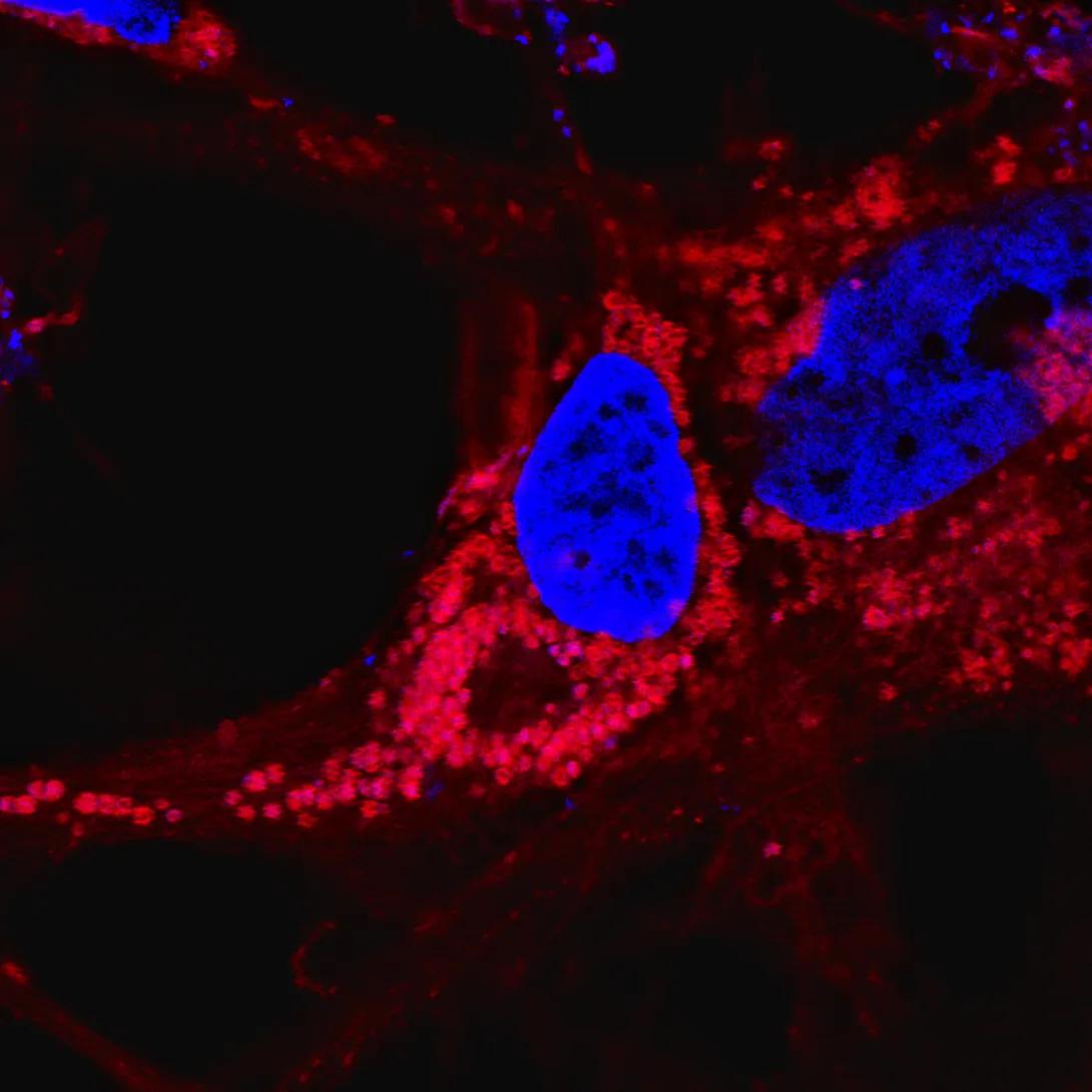 extracellular vesicles surrounding a nucleus
