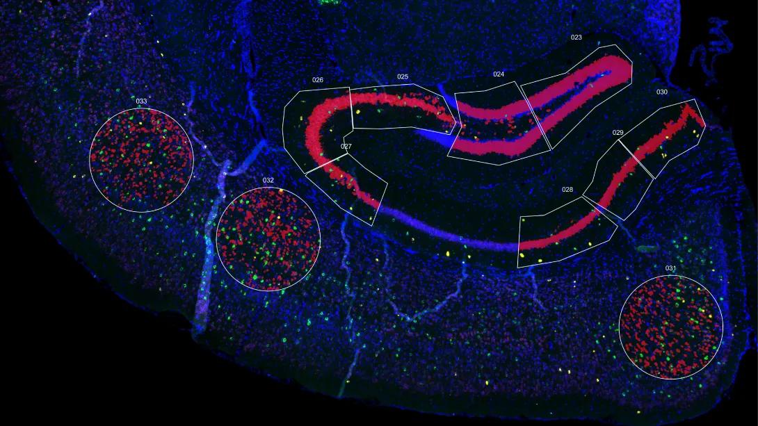 Animal brain hippocampus stained for interneurons and ran for spatial tanscriptonomics.  Green and yellow are interneurons.