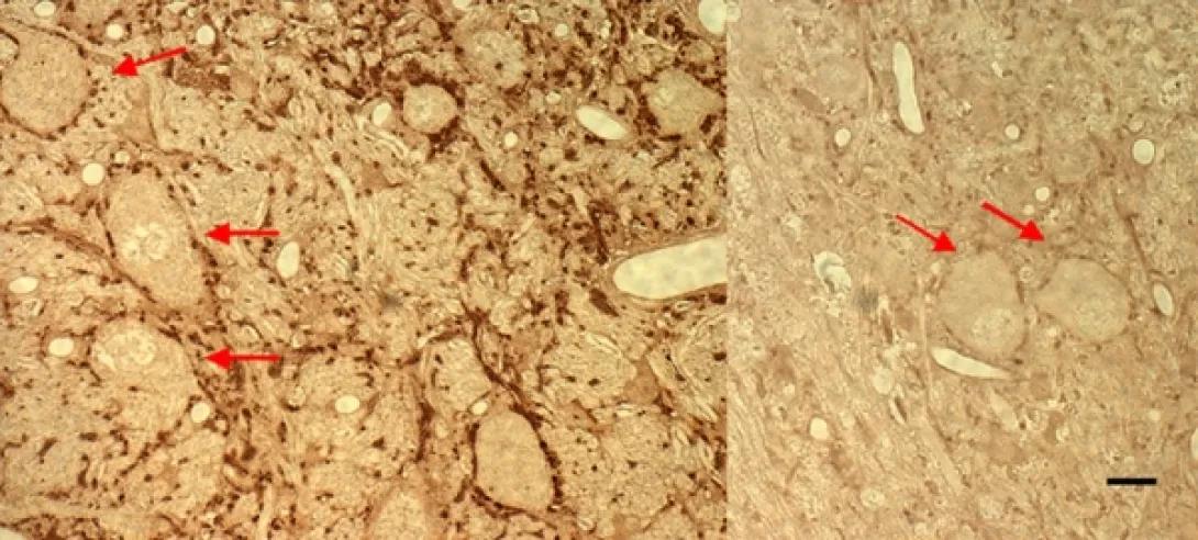 khri_altschulerlab_neurotransmission1_0