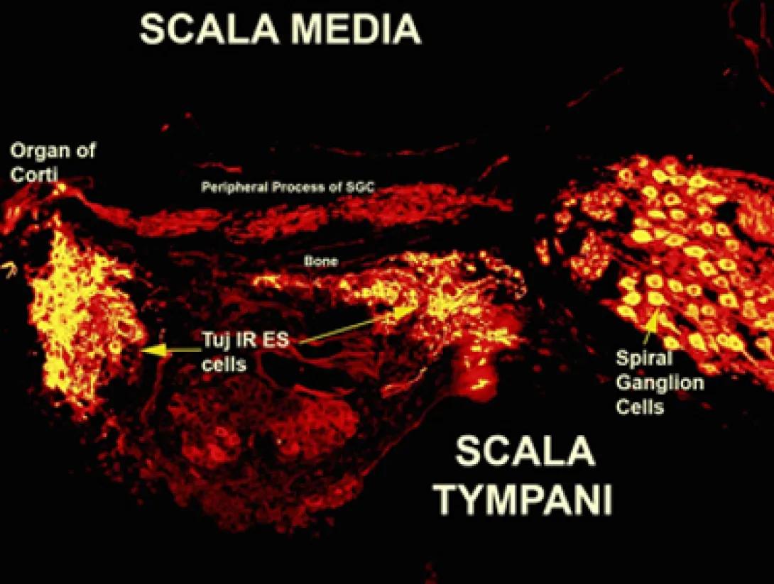 khri_altschulerlab_stemcells