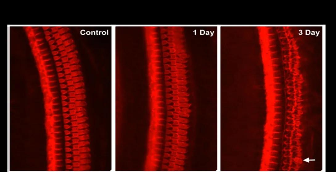Massive loss of hair cells within 3 days of one dose. Control Panel wth many hair cells vs 1 day loss panel with thinner visual, then 3 days with even more cells gone.