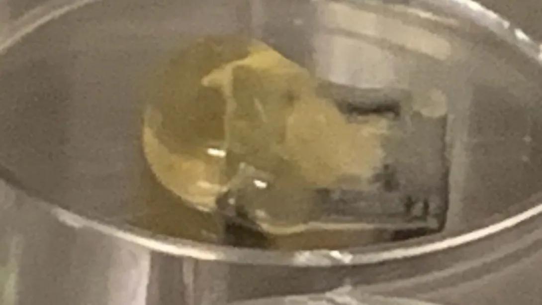 brain organoid grown in a lab