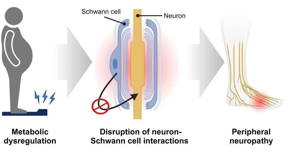 Graphic showing a person with metabolic dysregulation with an arrow to a graphic showing the disruption of a neuron and Schwann cells and an arrow to a foot with peripheral neuropathy