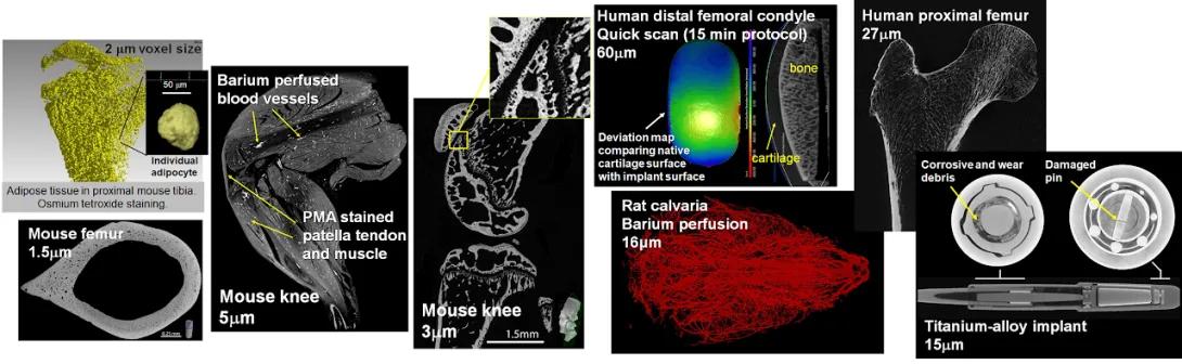 Image showing various high-resolution scans of biological and mechanical structures, including mouse femur, knee, rat calvaria, human femur, and titanium implant.