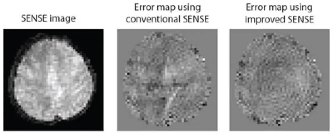 SENSE image and error maps showing reduction of aliasing artifact 