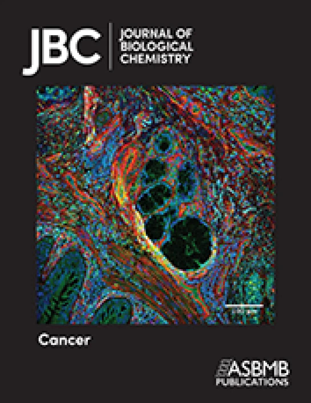 highlighted_in_jbc_special_virtual_issue_on_tumor_metabolism