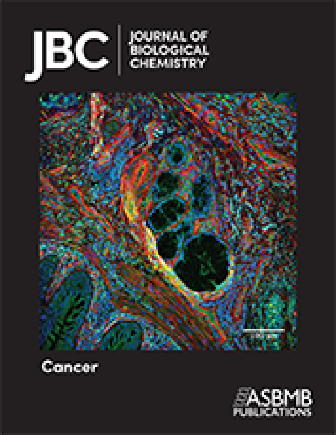 highlighted_in_jbc_special_virtual_issue_on_tumor_metabolism