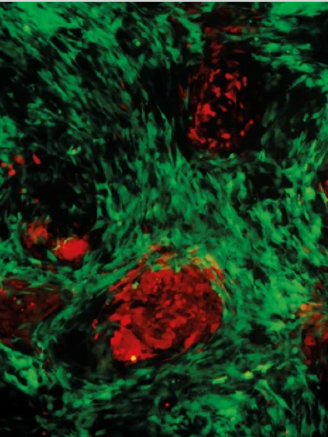 highlighted_in_nature_reviews_gastroenterology_hepatology_2016._pancreatic_cancer-_stromal_crosstalk_supports_tumour_metabolism
