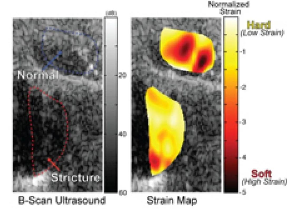 Stidham Research Image callout