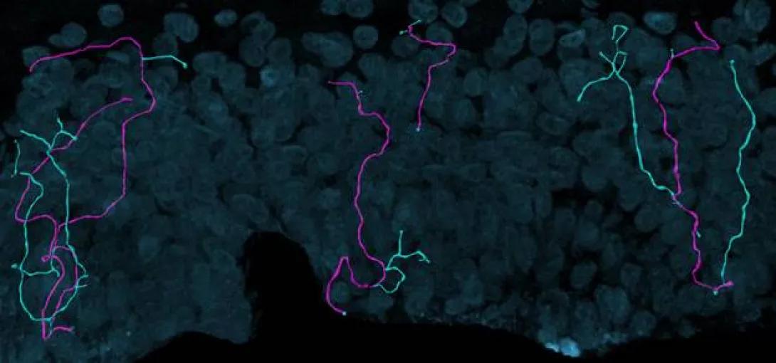 Three dimensional Measurements of Intraepidermal Nerve Fiber