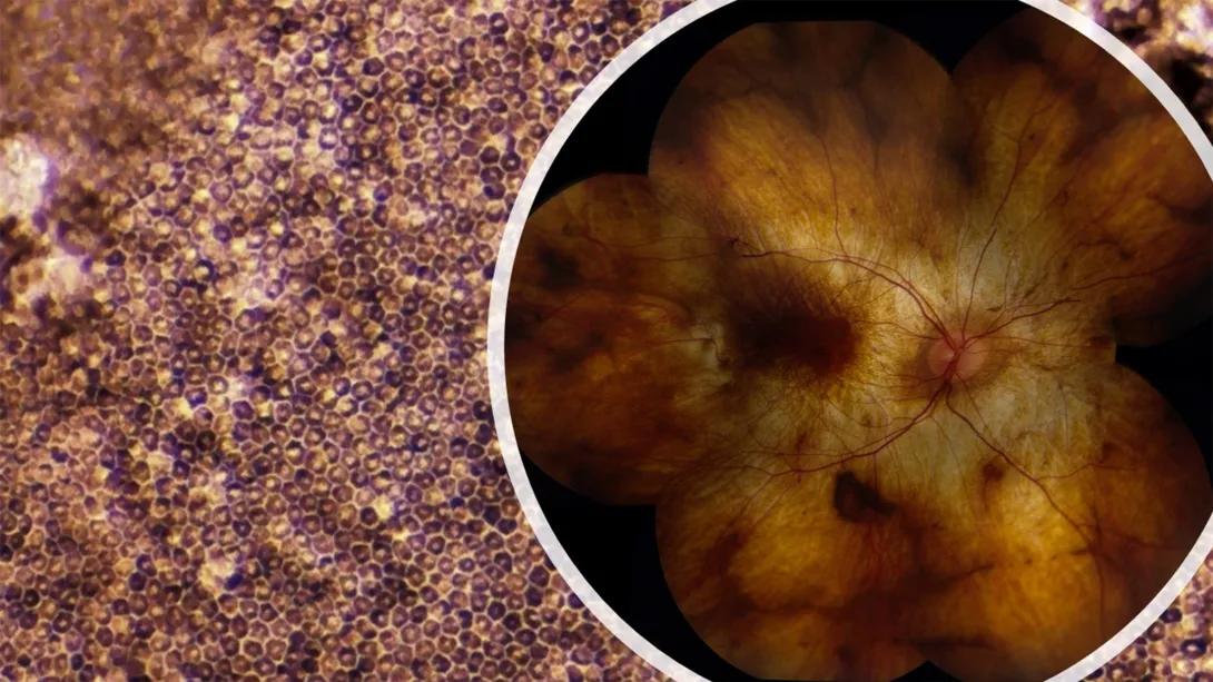 Fahim lab research for ophthalmology and visual Sciences