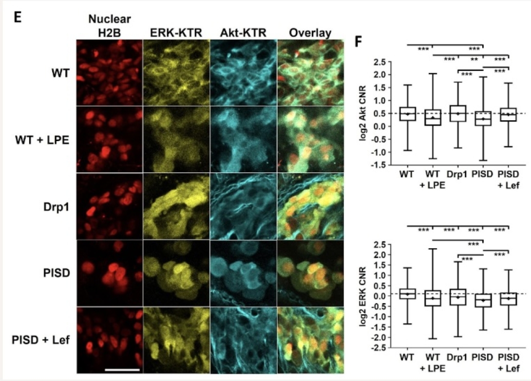Enhanced mitochondrial fission suppresses signaling and metastasis in triple-negative breast cancer.
