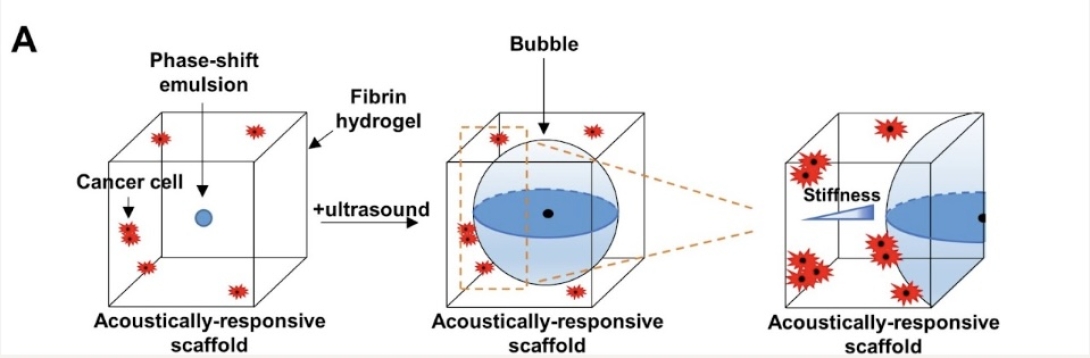 Ultrasound-induced mechanical compaction in acoustically responsive scaffolds promotes spatiotemporally modulated signaling in triple negative breast cancer.
