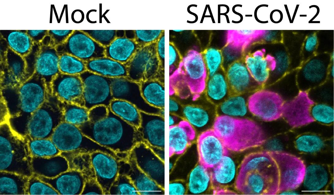 research image of Mock and SARS-CoV-2