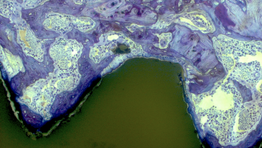 Image 11: Toluidine Blue, implant, thick plastic, 100X