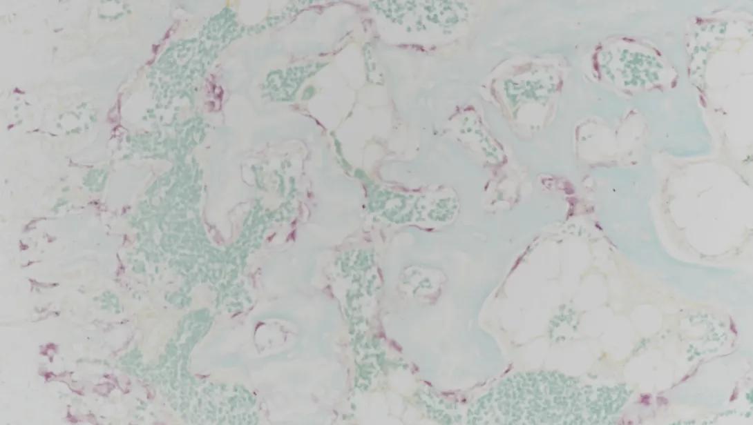 TRAP, mouse vertebrae, paraffin, 200X