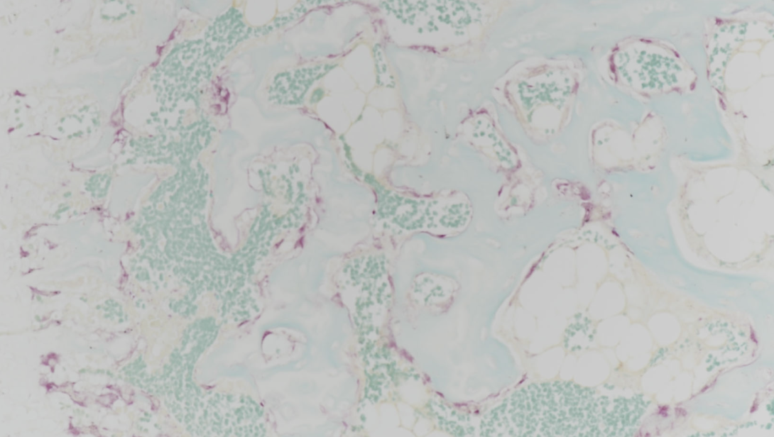TRAP, mouse vertebrae, paraffin, 200X