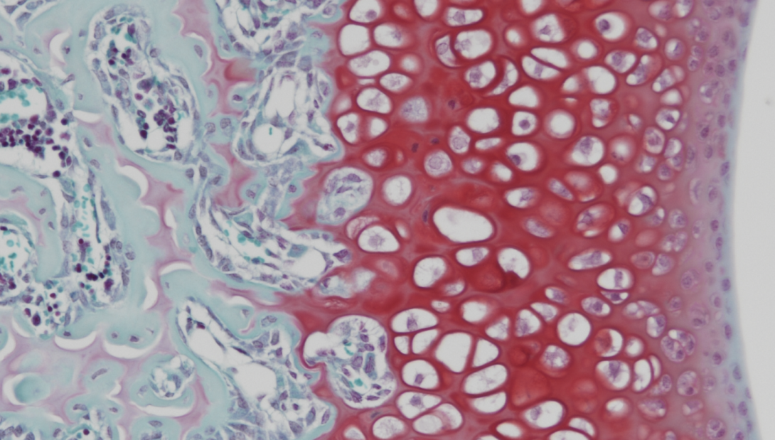 SafO/Fast Green, mouse femur, paraffin, 100X