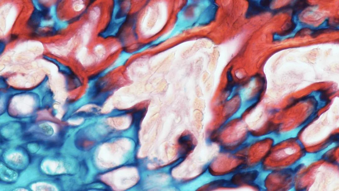 RGB Trichrome, mouse longbone, paraffin, 200X