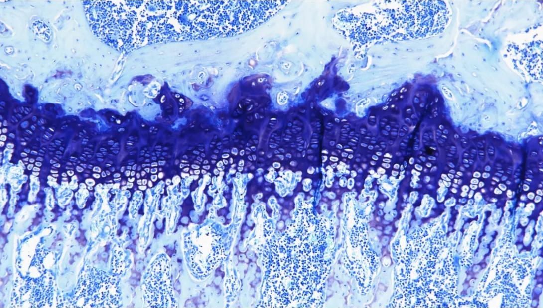 Toluidine Blue, mouse tibia, paraffin, 100X