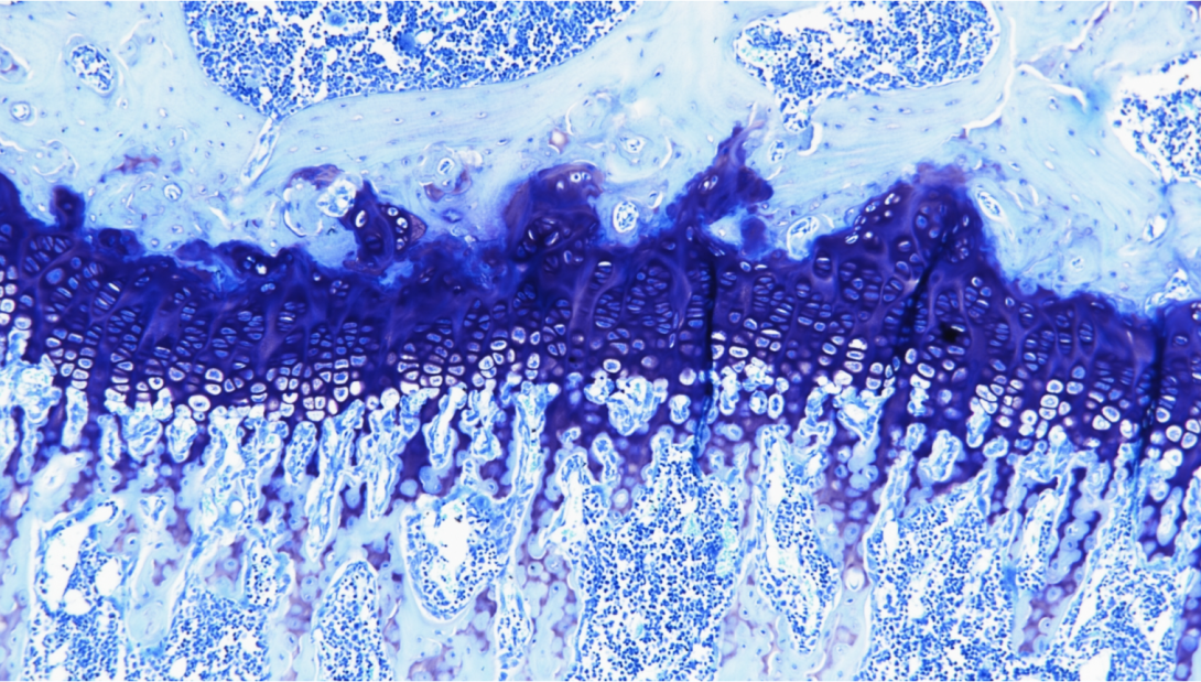 Toluidine Blue, mouse tibia, paraffin, 100X