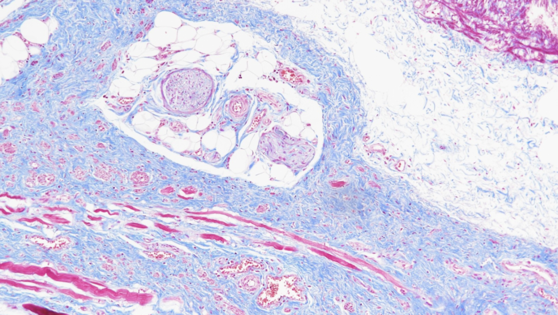 Carstairs, human urethra, paraffin, 100X