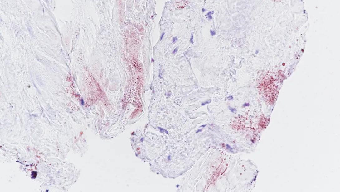 Oil Red O, human tendon cross section, frozen, 40X