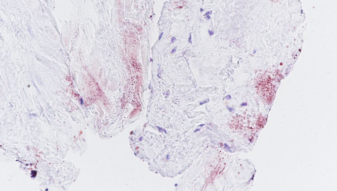 Oil Red O, human tendon cross section, frozen, 40X