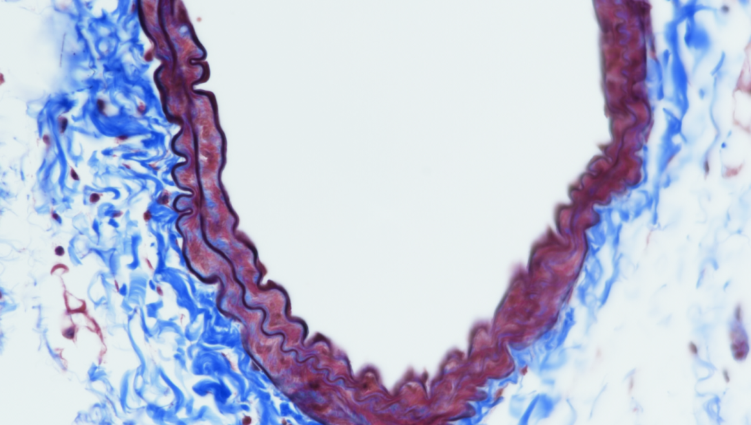 Masson Trichrome with Verhoeff Counterstain, mouse artery, paraffin, 40X