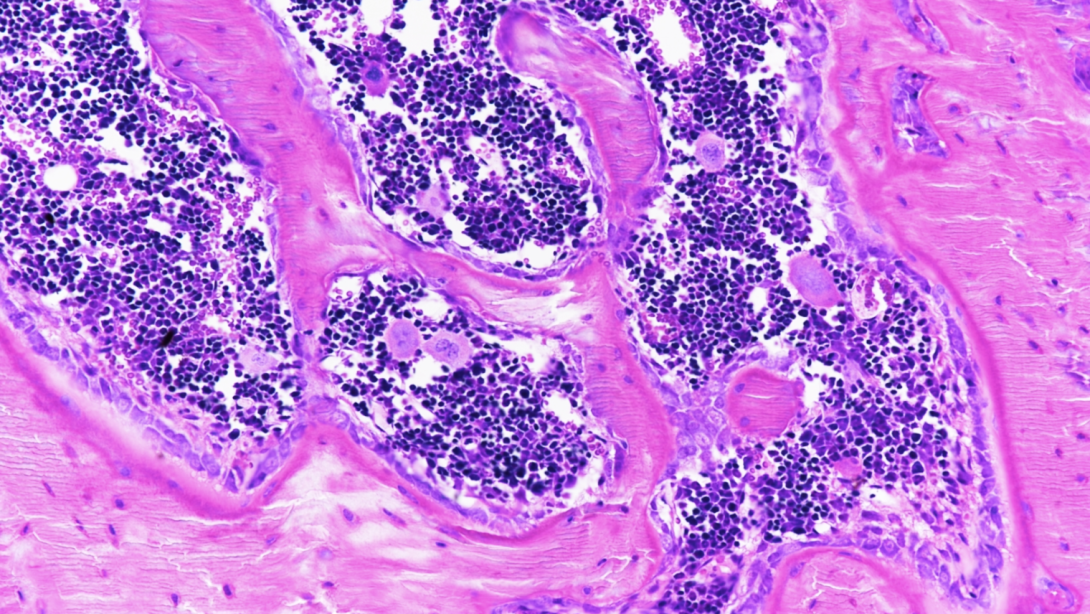 Toluidine Blue-Basic Fuchsin, mouse femur, thin plastic, 200X