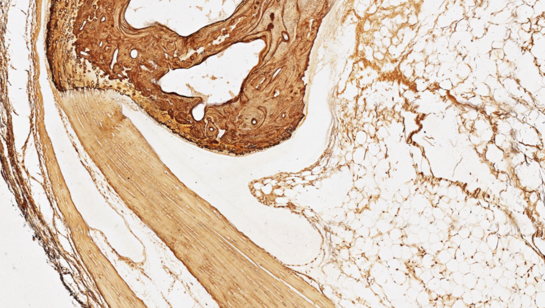 Silver Stain, mouse bone and tendon, paraffin, 40X