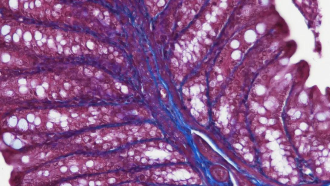 Masson's Trichrome, mouse intestine, paraffin 100X