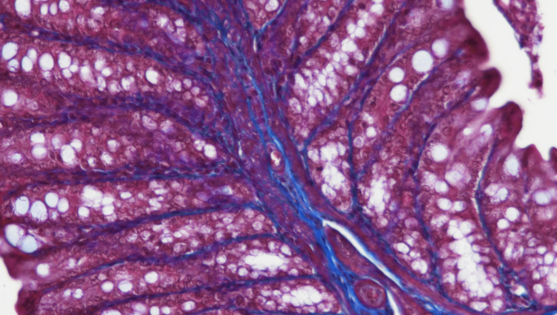 Masson's Trichrome, mouse intestine, paraffin 100X