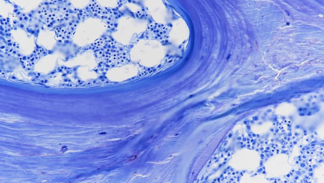 Toluidine Blue, human iliac crest biopsy, thin plastic, 200X