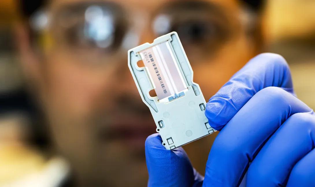 Lab tech holds up a biomarker slide