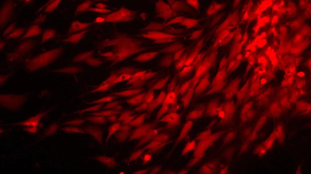 Primary fibroblast cultures