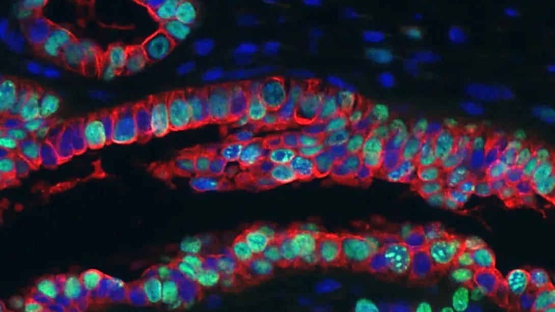 In vivo mouse models